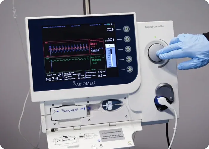 Abiomed Automated Impella Controller displaying its interface and controls.